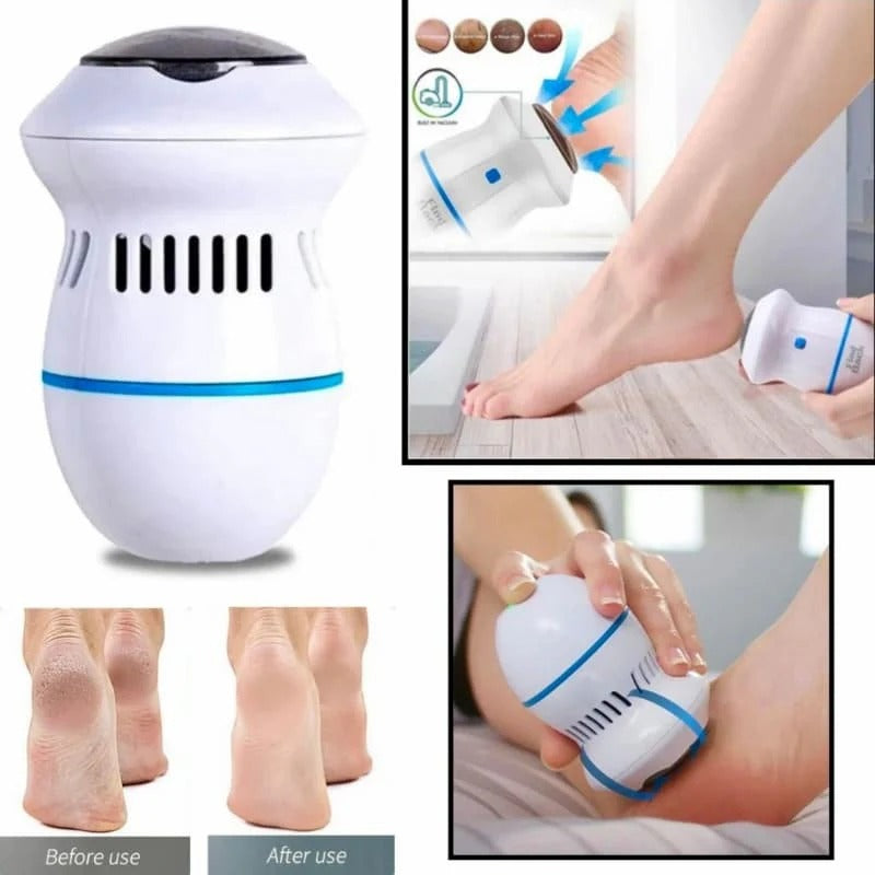 Electric Vacuum Foot Grinder Pedicure Tool